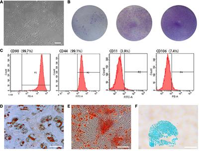 Hepatocyte Growth Factor-Induced Tendon Stem Cell Conditioned Medium Promotes Healing of Injured Achilles Tendon